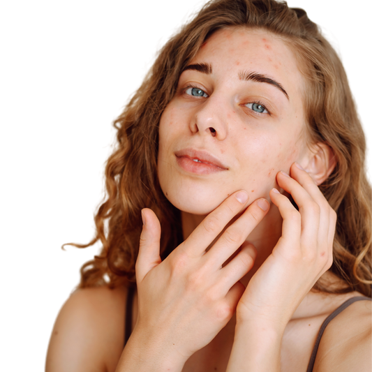 Skin Detox - Siero Purificante Viso con Acido Salicilico - 30ml