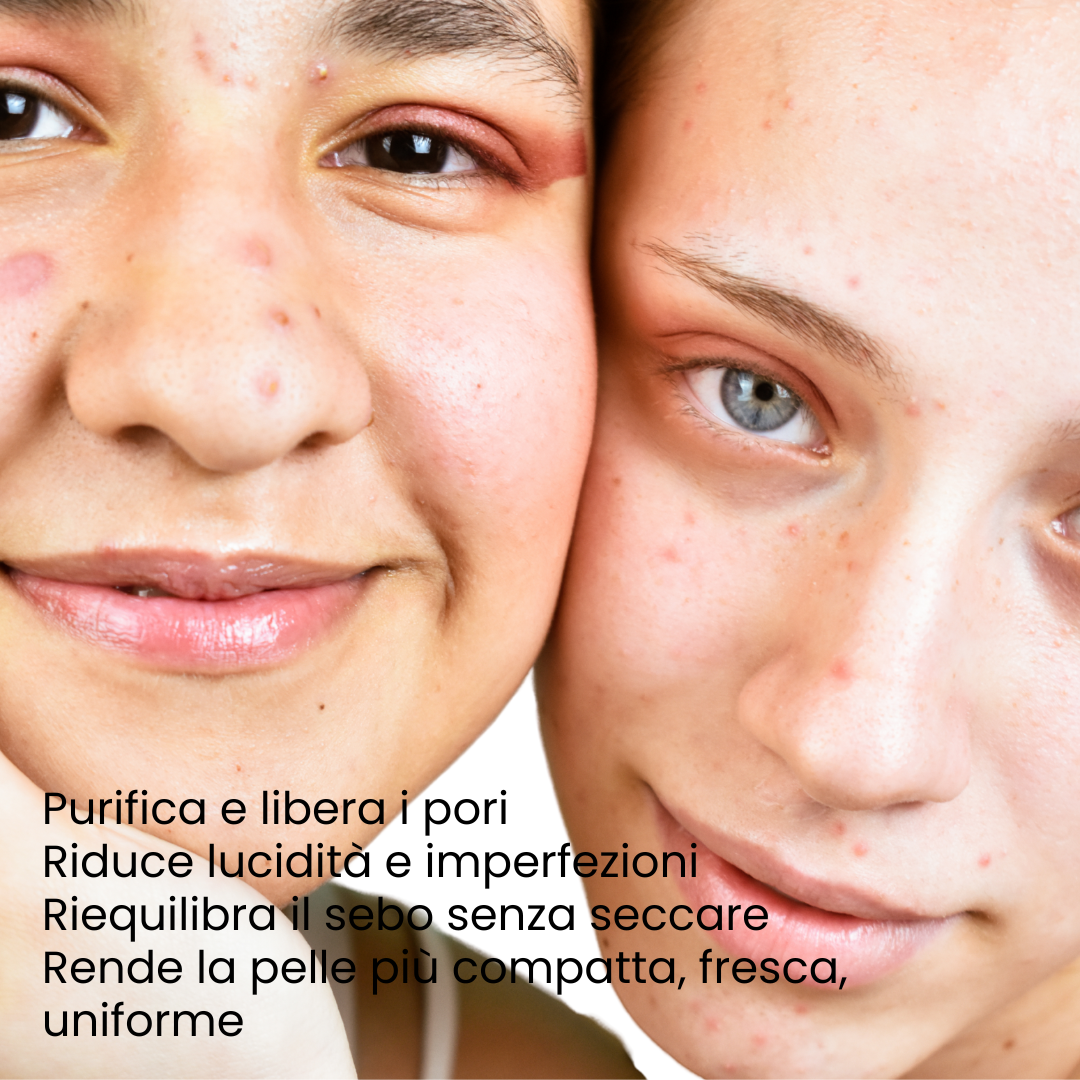 Skin Detox - Siero Purificante Viso con Acido Salicilico - 30ml